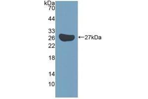 Detection of Recombinant KATNA1, Mouse using Polyclonal Antibody to Katanin P60 Subunit A 1 (KATNA1)