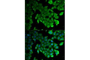 Immunofluorescence analysis of HeLa cells using MAP1LC3A antibody. (LC3A / LC3B antibody)
