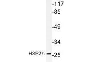 Western blot analyzes of HSP27 antibody in extracts from Jurkat cells.