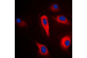 Immunofluorescent analysis of PLA2G4A staining in HeLa cells. (PLA2G4A antibody  (Center))