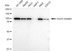 Western blotting analysis using Insulin receptor antibody (ABIN7799045).