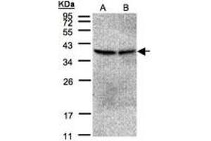 Image no. 1 for anti-Protein Phosphatase 2, Catalytic Subunit, beta Isozyme (PPP2CB) (AA 134-291) antibody (ABIN467440)