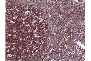 Immunohistochemical staining of formalin-fixed paraffin-embedded human tonsil tissue showing nuclear staining with RELA polyclonal antibody  at 1 : 100 dilution. (NF-kB p65 antibody  (N-Term))