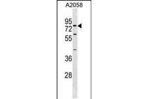 Western blot analysis in A2058 cell line lysates (35ug/lane). (SYT16 antibody  (AA 297-325))