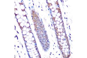 Immunohistochemistry of paraffin-embedded human colon using SKP2 Rabbit mAb (ABIN1680764, ABIN3018459, ABIN3018460 and ABIN7101615) at dilution of 1:100 (40x lens). (SKP2 antibody)