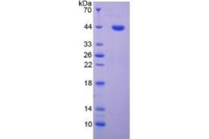 SDS-PAGE (SDS) image for Cyclin-Dependent Kinase 2 (CDK2) ELISA Kit (ABIN6730873)