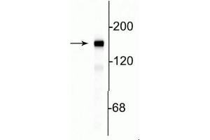 Western blot of rat cortical lysate showing specific immunolabeling of the ~145 kDa NF-M protein. (NEFM antibody  (C-Term))