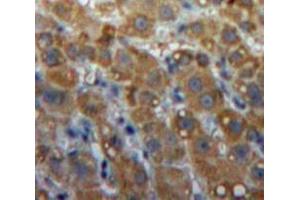 #VALUE! (LIPG antibody  (AA 115-369))