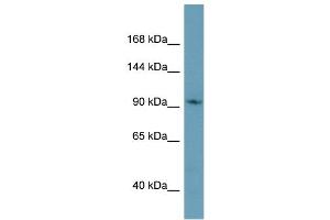 Western Blotting (WB) image for anti-Cap Methyltransferase 1 (CMTR1) (C-Term) antibody (ABIN2786076) (CMTR1 antibody  (C-Term))