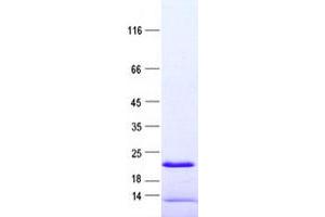 Western Blotting (WB) image for Chromosome 9 Open Reading Frame 72 (C9ORF72) protein (His tag) (ABIN2712986)