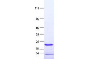 Validation with Western Blot (C9ORF72 Protein (His tag))