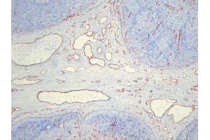 Immunohistochemistry (IHC) image for anti-Endothelial Cells antibody (ABIN781798) (Endothelial Cells antibody)