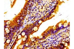 Immunohistochemistry of paraffin-embedded human small intestine tissue using ABIN7159843 at dilution of 1:100 (MTCH2 antibody  (AA 31-131))