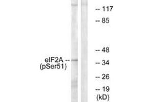 Western blot analysis of extracts from K562 cells treated with IFN-alpha 1000U/ml 18h, using eIF2 alpha (Phospho-Ser51) Antibody. (EIF2A antibody  (pSer52))