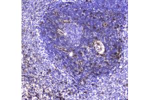 IHC analysis of S100A10 using anti-S100A10 antibody . (S100A10 antibody  (AA 4-94))