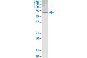 SLC6A3 MaxPab rabbit polyclonal antibody. (SLC6A3 antibody  (AA 1-620))