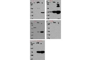 Immunoprecipitating Flag Tag in 293F transfected whole cell lysate Lane 1: Mouse control IgG instead of  in Flag Tag in 293F transfected whole cell lysate. (DYKDDDDK Tag antibody)
