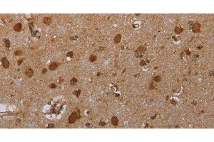 Immunohistochemistry of paraffin-embedded Human brain tissue using ATP2A1 Polyclonal Antibody at dilution 1:30 (ATP2A1/SERCA1 antibody)
