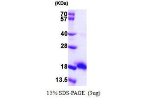 SDS-PAGE (SDS) image for Ecotin (AA 21-162) protein (His tag) (ABIN667329) (Ecotin (AA 21-162) protein (His tag))