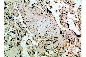 Immunohistochemical analysis of paraffin-embedded human-placenta, antibody was diluted at 1:200 (FLT4 antibody  (AA 640-700))