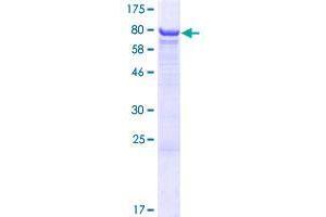 CES3 Protein (AA 1-568) (GST tag)