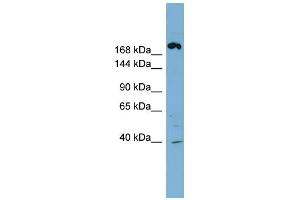 WB Suggested Anti-ABCC11 Antibody Titration:  0. (ABCC11 antibody  (Middle Region))