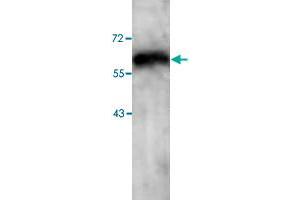 Western blot analysis of HepG2 cell lysate with PARP3 polyclonal antibody  at 1 : 250 dilution. (PARP3 antibody  (Internal Region))