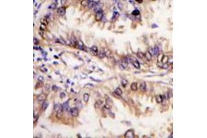 Image no. 3 for anti-serine threonine Kinase 39 (STK39) (C-Term) antibody (ABIN356942) (STK39 antibody  (C-Term))