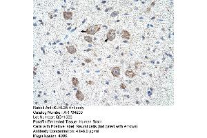 Human Brain (KLHL25 antibody  (N-Term))