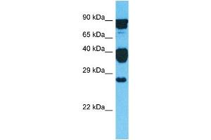 Western Blotting (WB) image for anti-GLI Pathogenesis-Related 1 Like 2 (GLIPR1L2) (C-Term) antibody (ABIN2791969)