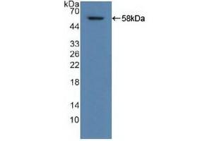 Detection of Recombinant ALDH1A1, Human using Polyclonal Antibody to Aldehyde Dehydrogenase 1 Family, Member A1 (ALDH1A1) (ALDH1A1 antibody  (AA 2-501))