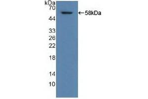 Detection of Recombinant ALDH1A1, Human using Polyclonal Antibody to Aldehyde Dehydrogenase 1 Family, Member A1 (ALDH1A1) (ALDH1A1 antibody  (AA 2-501))