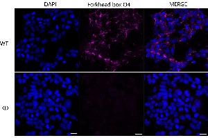 Immunocytochemical staining of 293T cells using Forkhead box O4 antibody (ABIN7798648), 1:1,000), Top panel: wild-type (WT), Bottom panal: Forkhead box O4 shRNA knockdown (KD).