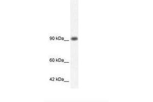 Image no. 3 for anti-RNA Binding Motif Protein 10 (RBM10) (AA 79-128) antibody (ABIN202953) (RBM10 antibody  (AA 79-128))