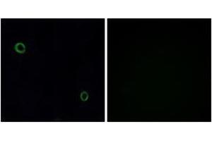 Immunofluorescence analysis of A549 cells, using CXCR4 Antibody. (CXCR4 antibody  (AA 300-349))