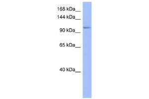 WB Suggested Anti-MSH4 Antibody Titration:  0. (MSH4 antibody  (Middle Region))