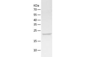 Western Blotting (WB) image for ATP-Binding Cassette, Sub-Family B (MDR/TAP), Member 6 (ABCB6) (AA 598-818) protein (His tag) (ABIN7121931) (ABCB6 Protein (AA 598-818) (His tag))