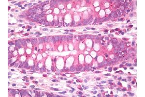 Anti-CB1 antibody IHC of human colon. (CNR1 antibody)