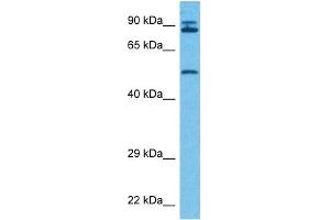 Western Blotting (WB) image for anti-phosphoenolpyruvate Carboxykinase 1 (Soluble) (PCK1) (Middle Region) antibody (ABIN2777603)