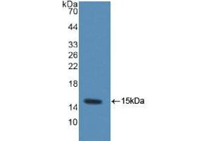Western blot analysis of recombinant Rat MRP1. (MRP1 antibody  (AA 21-115))