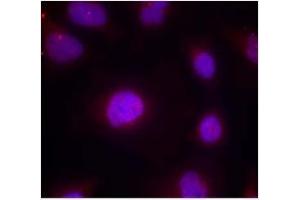 Image no. 2 for anti-Cyclin B1 (CCNB1) (pSer147) antibody (ABIN401594) (Cyclin B1 antibody  (pSer147))
