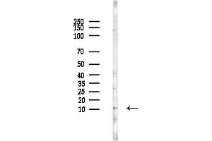 anti-Signal Recognition Particle 9kDa (SRP9) (Internal Region) antibody