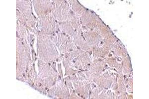 Immunohistochemistry (IHC) image for anti-Wingless-Type MMTV Integration Site Family, Member 10A (WNT10A) (C-Term) antibody (ABIN1030803)
