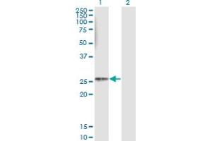 Western Blot analysis of HLA-DMB expression in transfected 293T cell line by HLA-DMB monoclonal antibody (M08), clone 4D12.