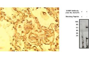 Image no. 1 for anti-Numb Homolog (NUMB) antibody (ABIN793714) (NUMB antibody)