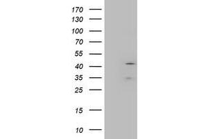 HEK293T cells were transfected with the pCMV6-ENTRY control (Left lane) or pCMV6-ENTRY LAYN (Right lane) cDNA for 48 hrs and lysed. (Layilin antibody)