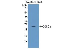 Western Blotting (WB) image for anti-CD99 (CD99) (AA 31-185) antibody (ABIN1867135) (CD99 antibody  (AA 31-185))