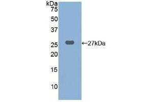 Detection of Recombinant CTSK, Human using Polyclonal Antibody to Cathepsin K (CTSK) (Cathepsin K antibody  (AA 115-329))