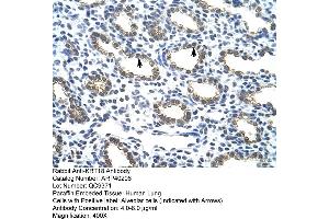 Rabbit Anti-KRT18 Antibody  Paraffin Embedded Tissue: Human Lung Cellular Data: Alveolar cells Antibody Concentration: 4. (Cytokeratin 18 antibody  (C-Term))