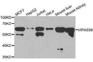 Western blot analysis of extracts of various cell lines, using VIPAS39 antibody. (VIPAR antibody  (AA 1-220))
